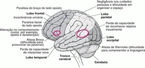 Estruturas Afetadas no AVC